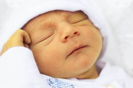 تدابیر پیشگیری از زردی نوزاد